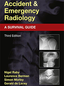 Accident and Emergency Radiology