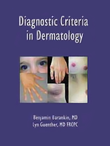 Diagnostic Criteria in Dermatology
