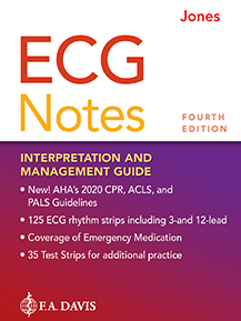 ECG Notes: Interpretation and Management Guide