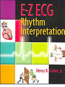 E-Z ECG Rhythm Interpretation