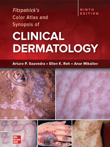 Fitzpatricks Color Atlas And Synopsis Of Clinical Dermatology