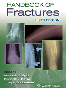 Handbook of Fractures