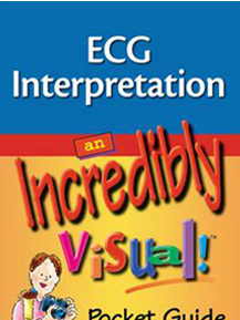 ECG Interpretation: An incredibly Visual Pocket Guide
