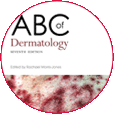abcderma6